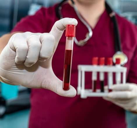 Testul de sânge care poate detecta cancerul cu șase ani înainte de apariție